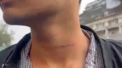 The bruises on the youth s neck after manjha misha 1770489351181