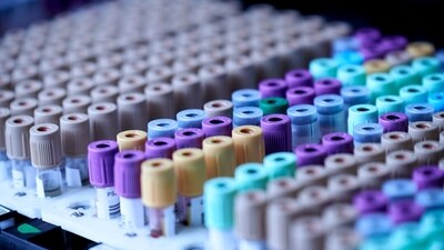 25 वर्षों के अनुभव वाले हृदय सर्जन ने हृदय रोग के जोखिम को निर्धारित करने के लिए 3 प्रयोगशाला परीक्षणों को साझा किया है जो लोग चूक जाते हैं