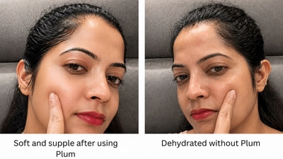 Plum Niacinamide Review 1777442764919 1777442770773