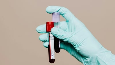 pexels photo 4040561 1775196964771 1777285662320