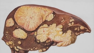 photo 1715529134972 221f23a6c701 1777119009641 1777119020273