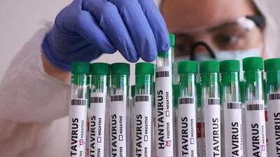 A test tube labelled Hantavirus positive is held 1778236657154