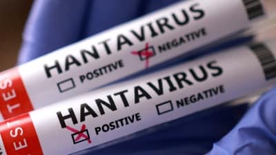 CRUISESHIP HANTAVIRUS 10 1778161391876 1778161398467