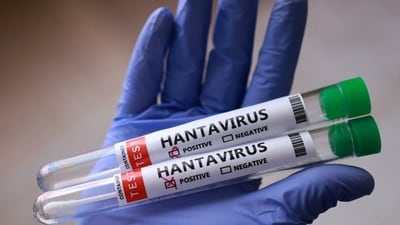 CRUISESHIP HANTAVIRUS 1778258166642 1778258166775