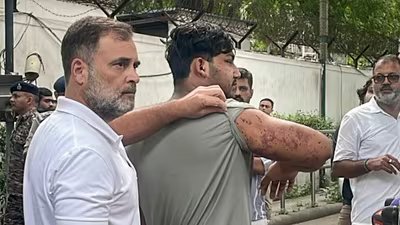 अंधापन, पक्षाघात, पीटीएसडी: सीजेपी विरोध कार्रवाई पर हंगामे के बीच विशेषज्ञों का कहना है कि छर्रे अपूरणीय क्षति का कारण बन सकते हैं