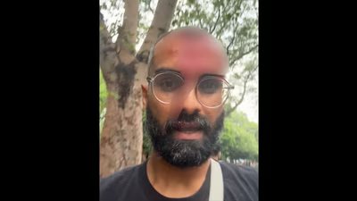 सीजेपी विरोध प्रदर्शन में सिर पर चोट लगने के बाद रमित वर्मा उर्फ ​​पीइंग ह्यूमन ने 11 साल बाद अपना चेहरा दिखाया